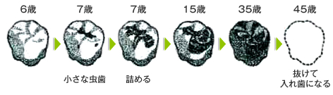 これまでの歯のライフスタイルイメージ画像