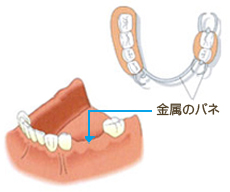 従来の治療法画像