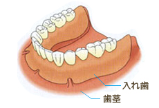 従来の治療法画像